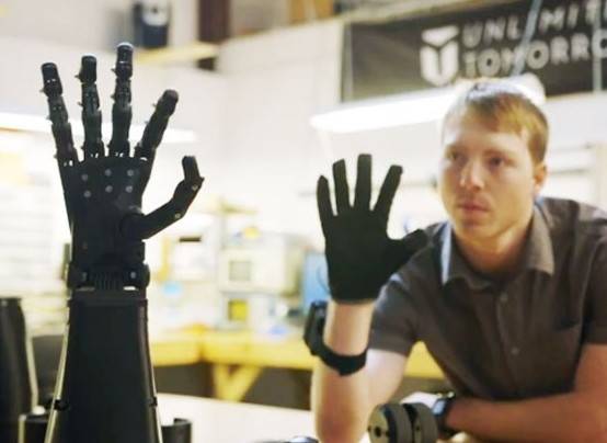 La Protesi Robotica del Giovanissimo Genio Easton LaChappelle